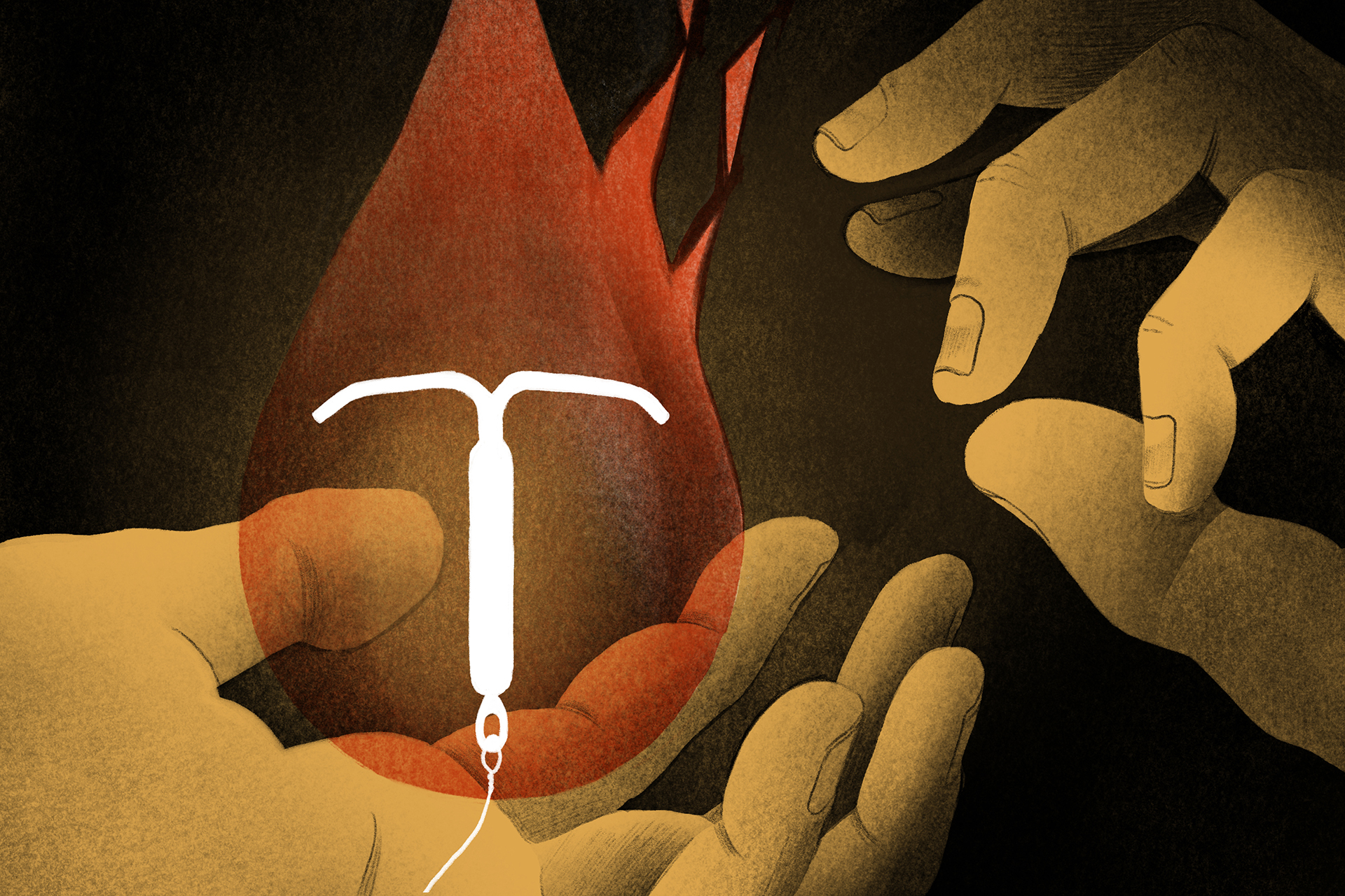 For years, women complained that this medical procedure was painful. Doctors are finally listening.